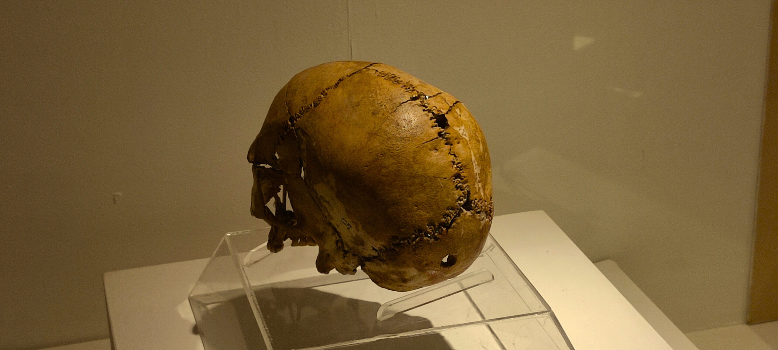 Neolithic Skull from Aşıklı: The Obsidian Incision
